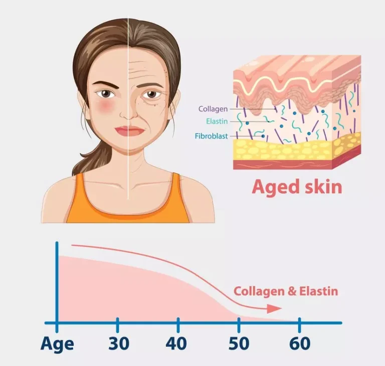 Anti Aging