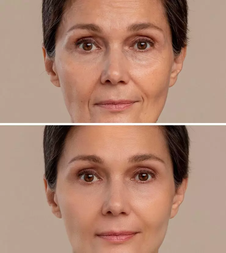 Antiaging